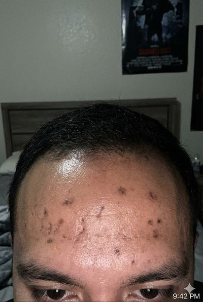 Before